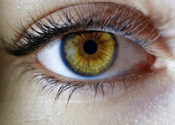 Cirurgia para mudar a cor dos olhos vira ‘febre’ entre adolescentes