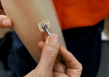 Campinas confirma duas primeiras mortes por febre maculosa em 2025