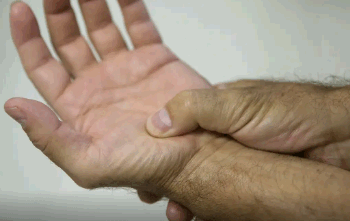 Lei define fibromialgia como deficiência em todo país a partir de 2026