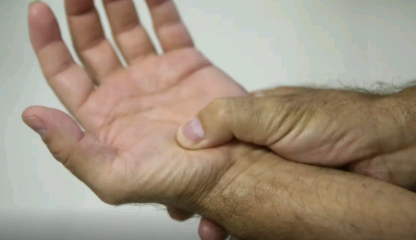 Lei define fibromialgia como deficiência em todo país a partir de 2026