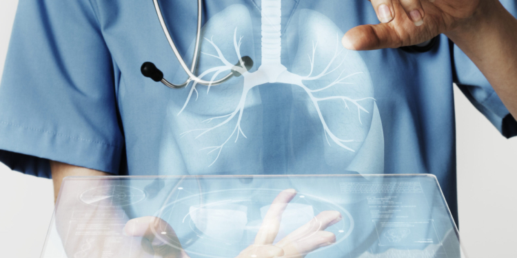 Agosto Branco: cerca de 25% das mortes por câncer no mundo são decorrentes do câncer de pulmão