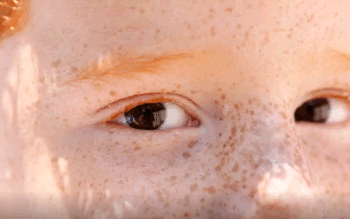 Reflexo branco nos olhos: entenda condição que assusta pais