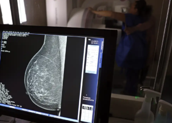 Ministério da Saúde passa a recomendar mamografia a partir dos 40 anos