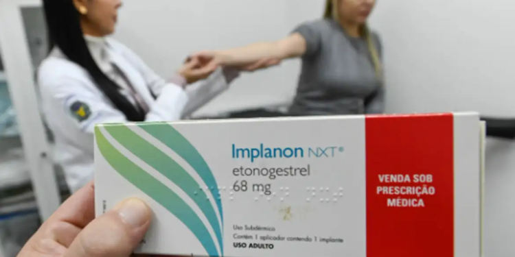Planos de saúde agora são obrigados a ofertar implante contraceptivo Implanon