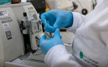 Cura de câncer de próstata pode chegar a até 98%