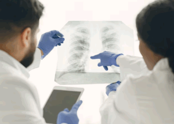 Necessidade urgente de aumentar o acesso ao diagnóstico de Tuberculose (TB) – por Carmino de Souza