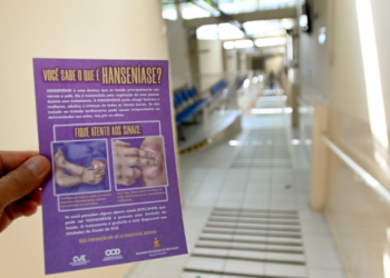 Janeiro Roxo: Saúde de Campinas alerta para sinais e prevenção da hanseníase