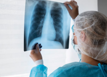 Broncopneumonia: entenda quadro que causou internação de Bolsonaro