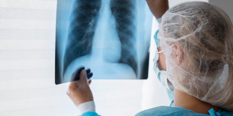 Broncopneumonia: entenda quadro que causou internação de Bolsonaro