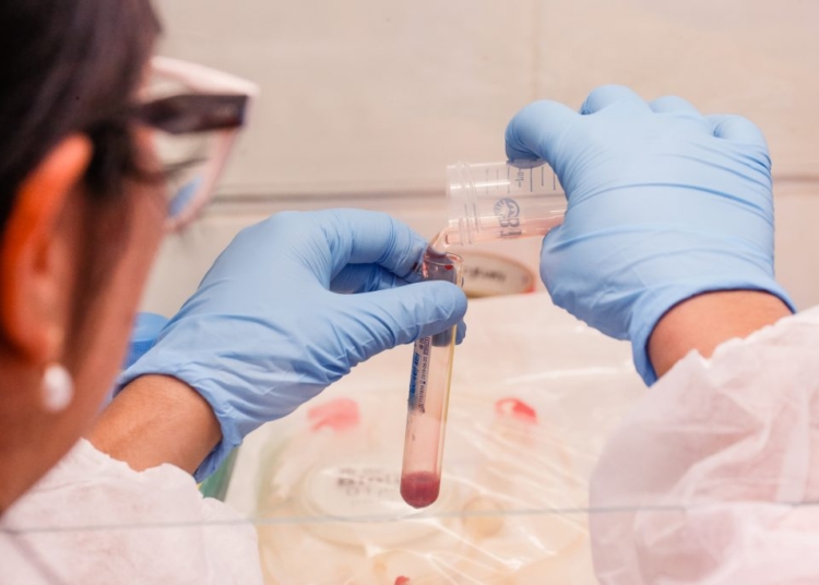 Exame de sangue associado à IA abre caminho para diagnóstico precoce da hanseníase