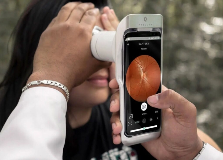 Campinas passa a oferecer no SUS municipal exame de retina com uso de IA