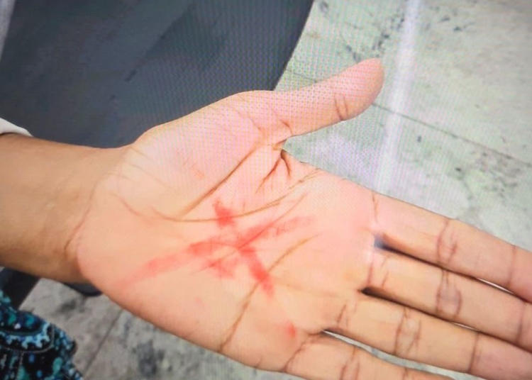 Mulher faz sinal de socorro com a mão e agressor é preso em Americana