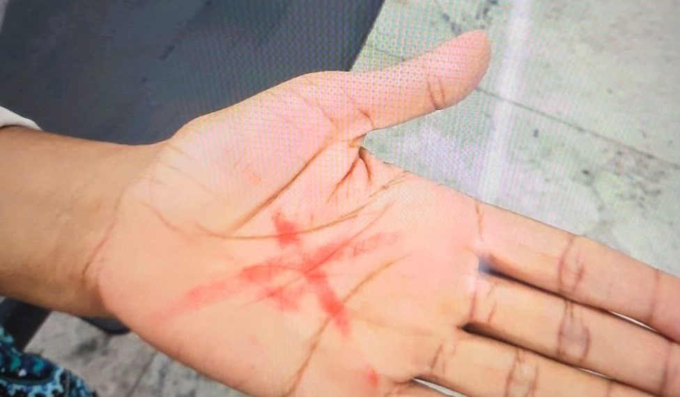 Mulher faz sinal de socorro com a mão e agressor é preso em Americana