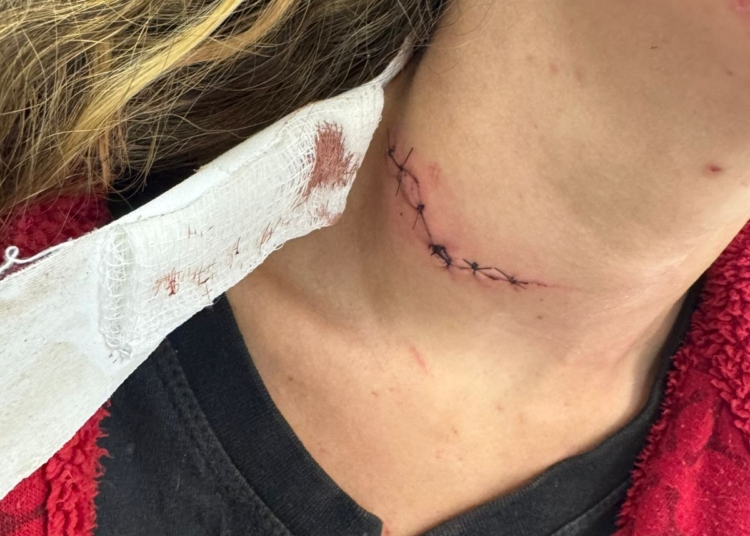 Homem é detido em Piracicaba após mulher dar entrada em UPA com corte no pescoço