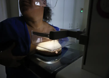 ANS defende que plano cubra mamografia digital sem restrição de idade