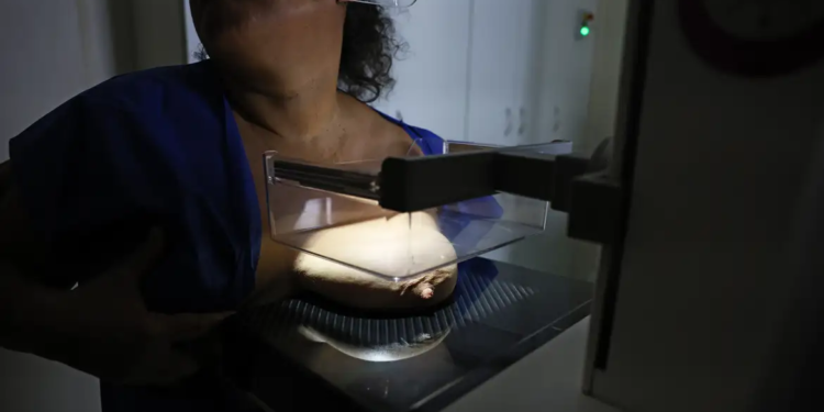ANS defende que plano cubra mamografia digital sem restrição de idade