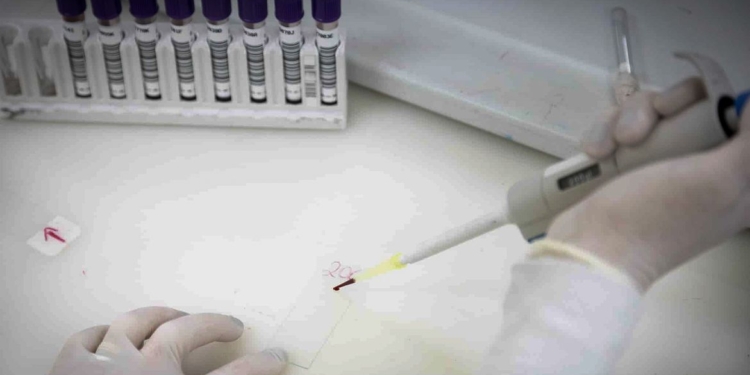 Exames descartam ebola em imigrante da República Democrática do Congo